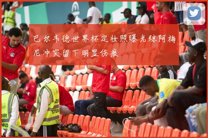 巴尔韦德世界杯定妆照曝光琼阿梅尼冲突留下明显伤痕